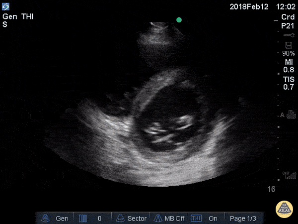 ezgif.com-optimize+(6)