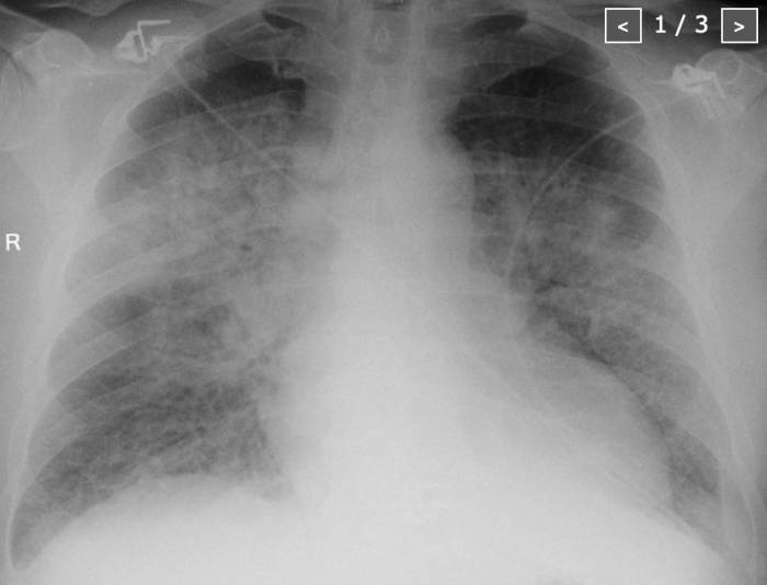 Screen Shot 2019-12-10 at 11.19.40 AM.png